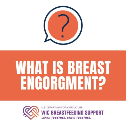 What is Breast Engorgement